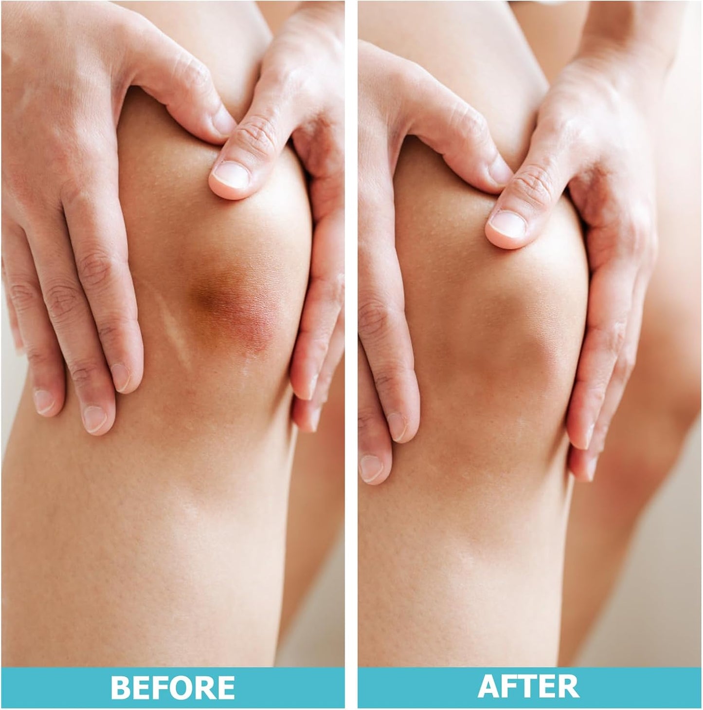 EasyHeal Recovery Wrap