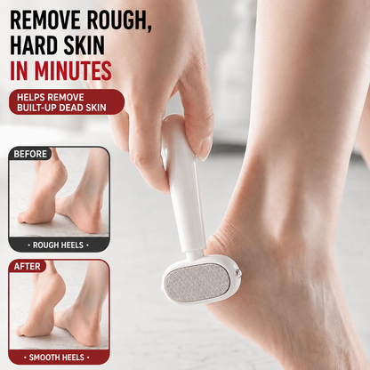 Smoother Feet at Home — Without Expensive Pedicures