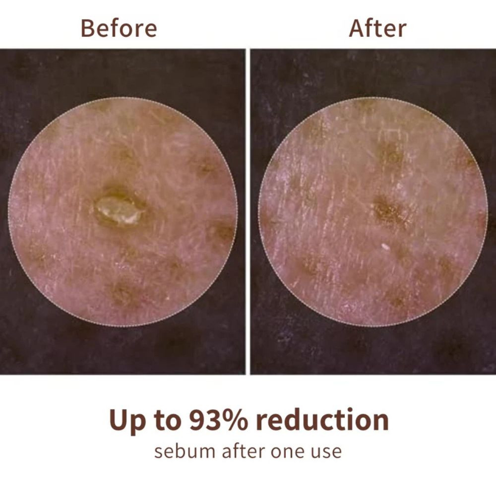 Dr Melaxin™ Peel Shot Ampoule