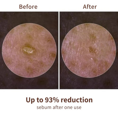 Dr Melaxin™ Peel Shot Ampoule